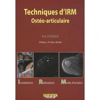 Techniques d irm osteo articulaire