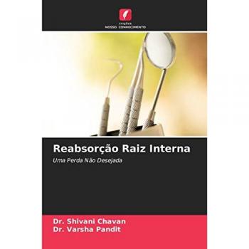 Reabsorção Raiz Interna: Uma Perda Não Desejada