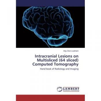 Intracranial Lesions on Multisliced