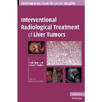 Interventional Radiological Treatment of Liver Tumors