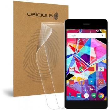 Anti-Glare Screen Armor – Archos Diamond S Set