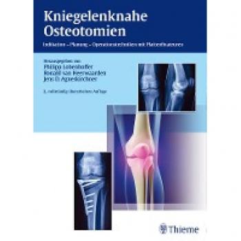 Kniegelenknahe Osteotomien, Fachbücher von Philipp Lobenhoffer, Jens Agneskirchner, Ronald van Heerwaarden