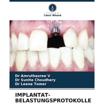 V, Amruthasree: IMPLANTAT-BELASTUNGSPROTOKOLLE
