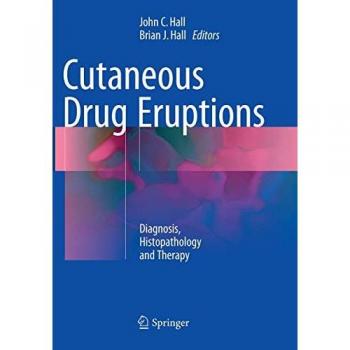 Cutaneous Drug Eruptions