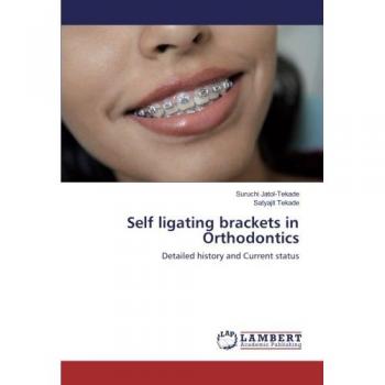 Self ligating brackets in Orthodontics