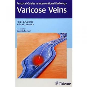 Varicose Veins: Practical Guides In Interventional Radiology