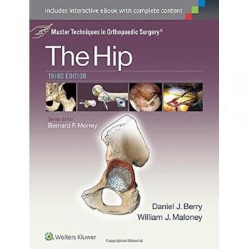 Master Techniques in Orthopaedic Surgery: The Hip
