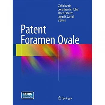 Patent Foramen Ovale
