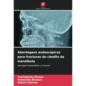 Biswal, Yashobanta: Abordagens endoscópicas para fracturas do côndilo da mandíbula