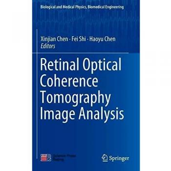 Retinal Optical Coherence Tomography Image Analysis