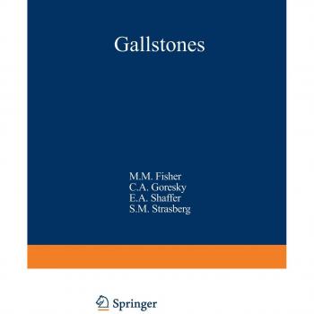Gallstones