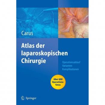 Operationsatlas Laparoskopische Chirurgie