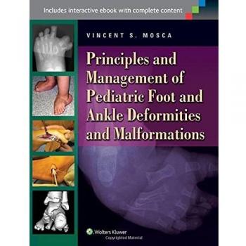 Principles and Management of Pediatric Foot and Ankle Deformities and Malformations