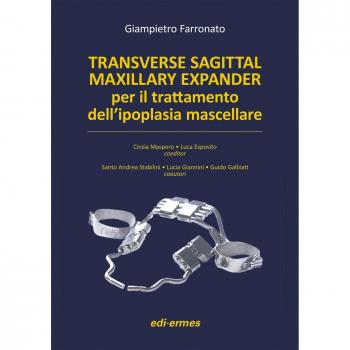 Transverse sagittal maxillary expander per il trattamento dell'ipoplasia mascellare