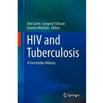 HIV and Tuberculosis