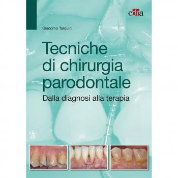 Tecniche di chirurgia parodontale. Dalla diagnosi alla terapia
