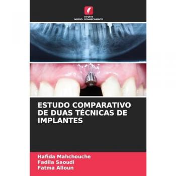 Mahchouche, Hafida: ESTUDO COMPARATIVO DE DUAS TÉCNICAS DE IMPLANTES