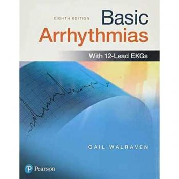 Basic Arrhythmias