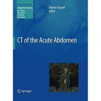 CT of the Acute Abdomen