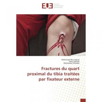 Fractures du quart proximal du tibia traitées par fixateur externe: DE