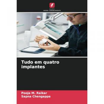 Raikar, Pooja M.: Tudo em quatro implantes