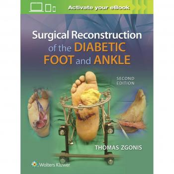 Lippincott Williams & Wilkins Surgical Reconstruction of the Diabetic Foot and Ankle