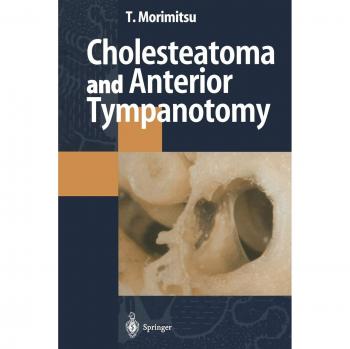 Cholesteatoma and Anterior Tympanotomy