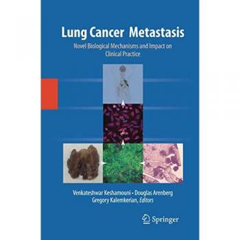 Lung Cancer Metastasis: Novel Biological Mechanisms and Impact on Clinical Practice