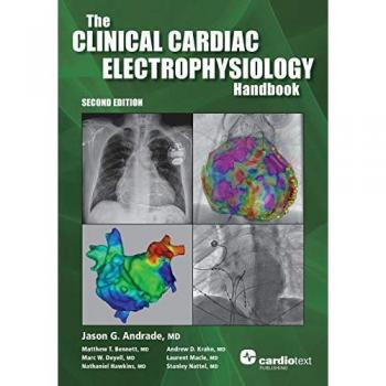 The clinical cardiac electrophysiology handbook, second edition.