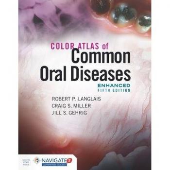 Jones & Bartlett Learning Color Atlas of Common Oral Diseases