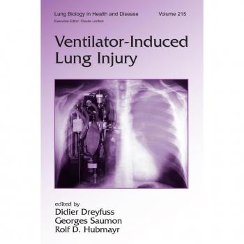 Vitalsource Technologies, Inc. Ventilator-induced Lung Injury