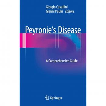 Peyronie's Disease: A Comprehensive Guide