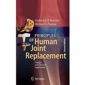 Principles of Human Joint Replacement: Design and Clinical Application