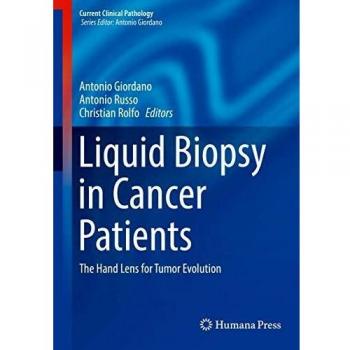Liquid Biopsy in Cancer Patients: The Hand Lens for Tumor Evolution