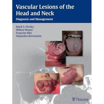 Vascular Lesions of the Head and Neck