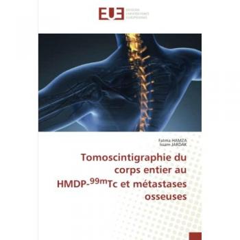 Hamza, Fatma: Tomoscintigraphie du corps entier au HMDP-99mTc et métastases osseuses