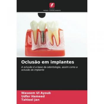 Oclusão em implantes: A oclusão é a base da odontologia, assim como a oclusão do implante