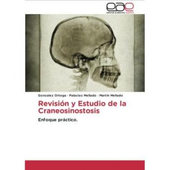 Revisión y Estudio de la Craneosinostosis: Enfoque práctico.