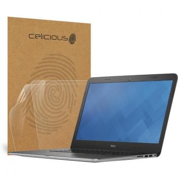 Celicious Vivid Crystal Clear Screen Protector for Dell Inspiron 15 7548