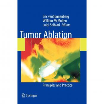 Tumor Ablation: Principles and Practice