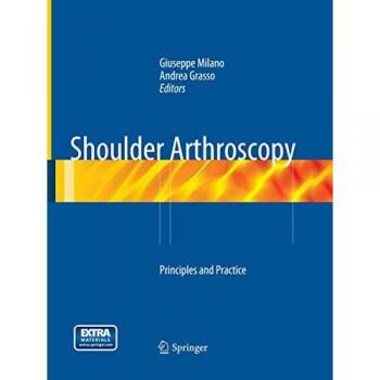 Shoulder Arthroscopy