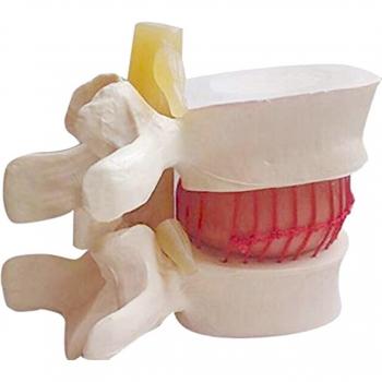 Lendenwirbelsäule Modell mit anatomischer Darstellung