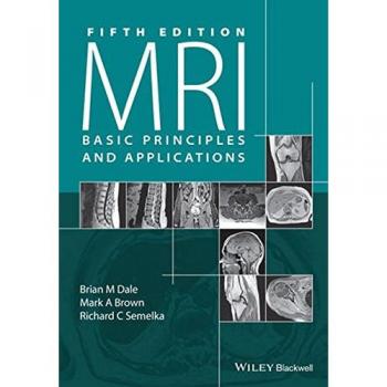 MRI: Basic Principles and Applications, Brian M. Dale, Mark A. Brown, Richard C.