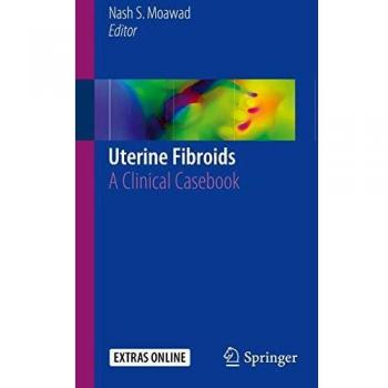 Uterine Fibroids: A Clinical Casebook