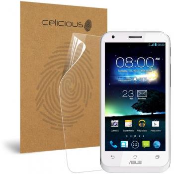 VividBarrier – 2K Clarity Shock‑Proof Protector