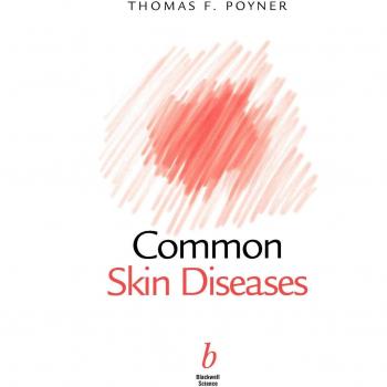 Common Skin Diseases