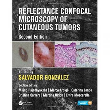 Reflectance Confocal Microscopy of Cutaneous Tumors