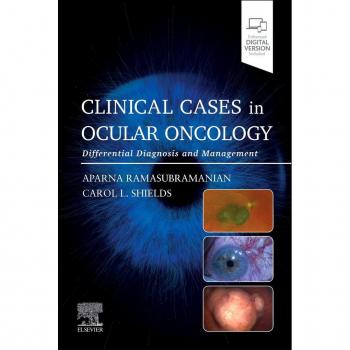 Clinical cases in ocular oncology