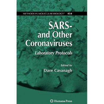 SARS