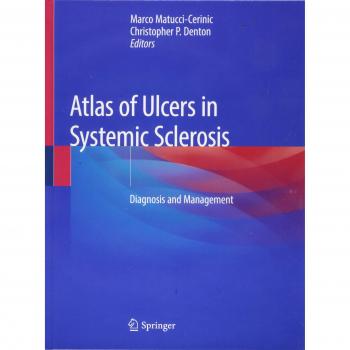Atlas of Ulcers in Systemic Sclerosis: Diagnosis and Management